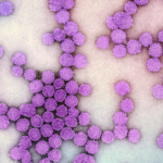 CDC Updates Measles Figures as the U.S. Records Two Deaths