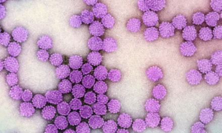CDC Updates Measles Figures as the U.S. Records Two Deaths