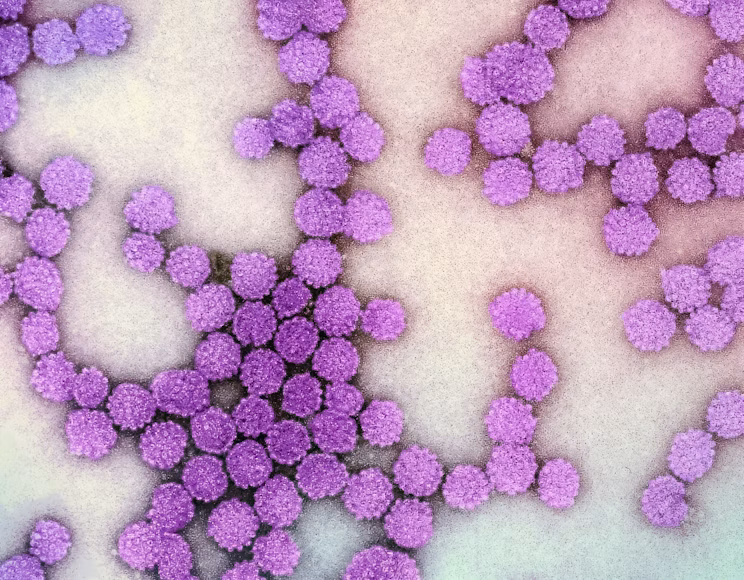 CDC Updates Measles Figures as the U.S. Records Two Deaths